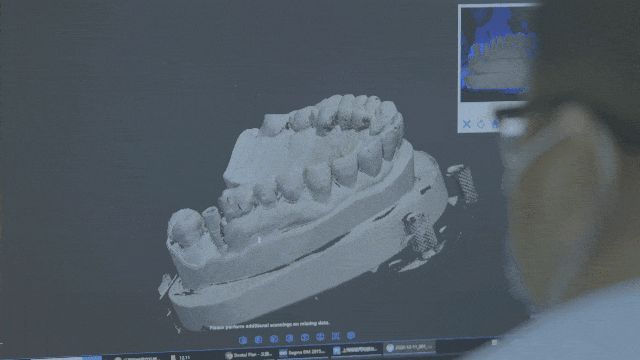 3D打印在口腔齿科领域都这么卷了吗？