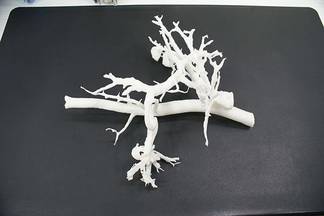 联泰答疑室 | 3D打印，我劝你在医疗行业别这么“嚣张”