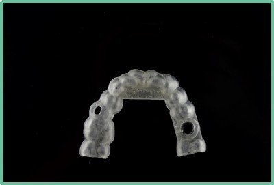 “以科技破局，以数字化赋能”——联泰科技与精瓷义齿共创齿科3D打印医疗新未来01