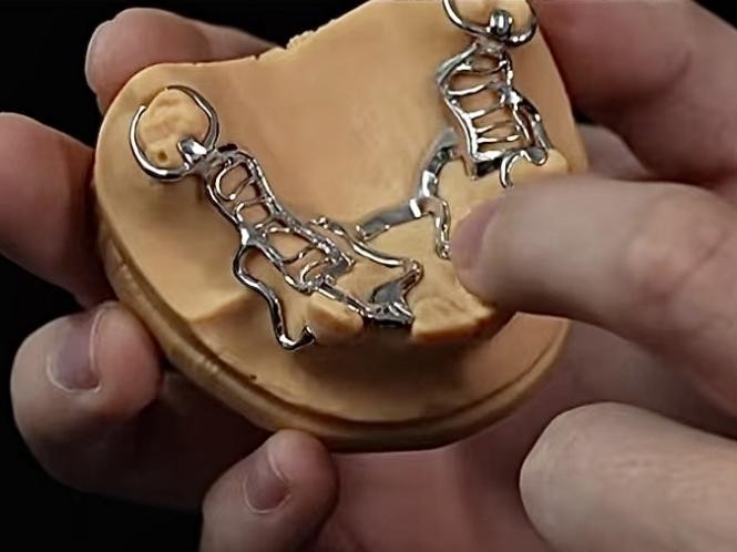 医疗器械3D金属打印