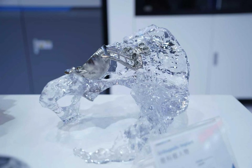金属3D打印医疗植入件